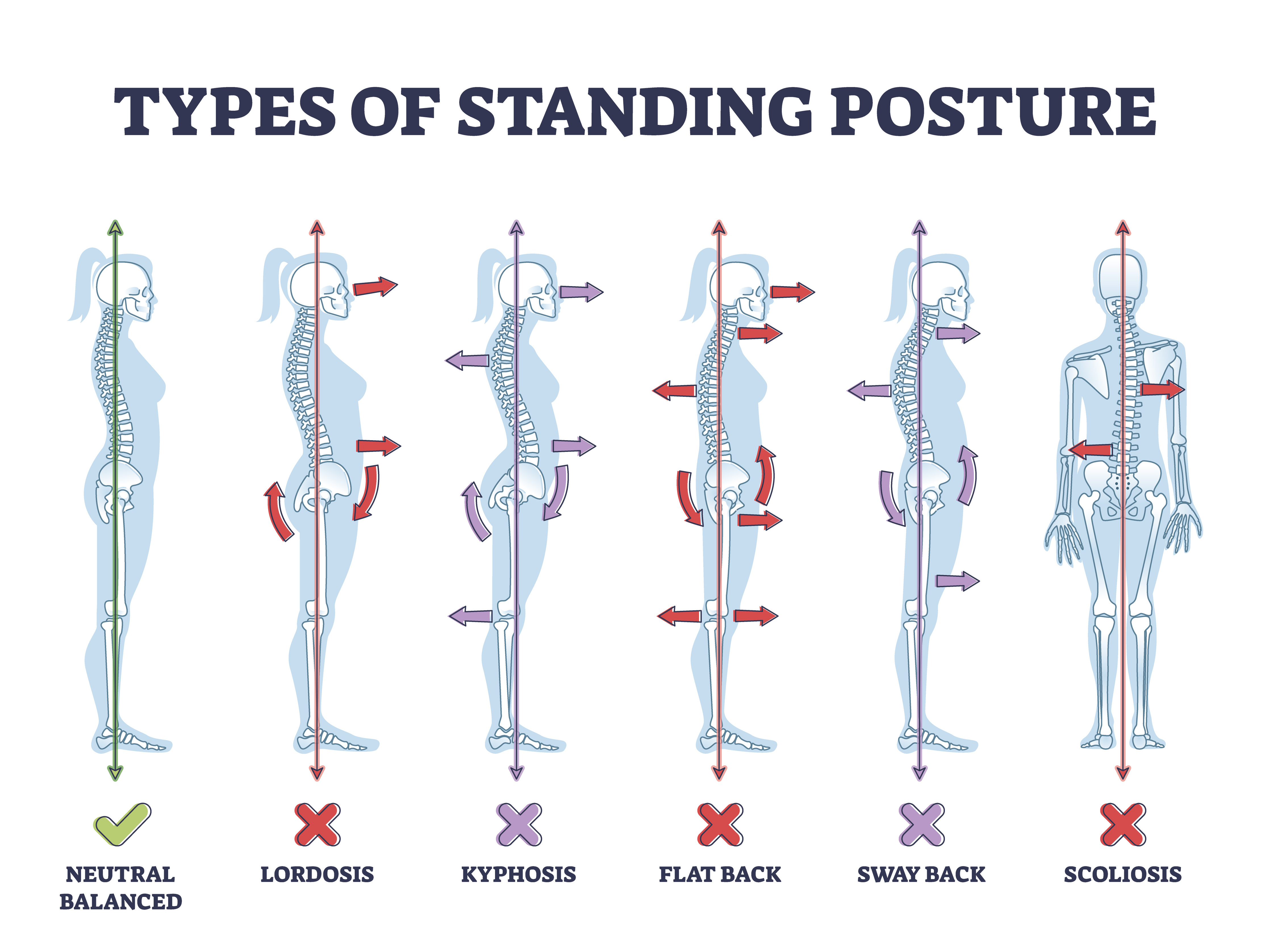 Postures